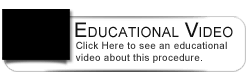 Dental Education Video - Invisalign Teen
